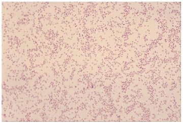 Brucellosis (Brucella): The Intracellular Cause of Undulant Fever, and How It Is Diagnosed