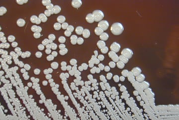 Burkholderia pseudomallei: Melioidosis, Pathogenesis, Diagnosis, Treatment 