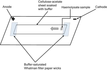 Cellulose Acetate Electrophoresis: Principle and Application