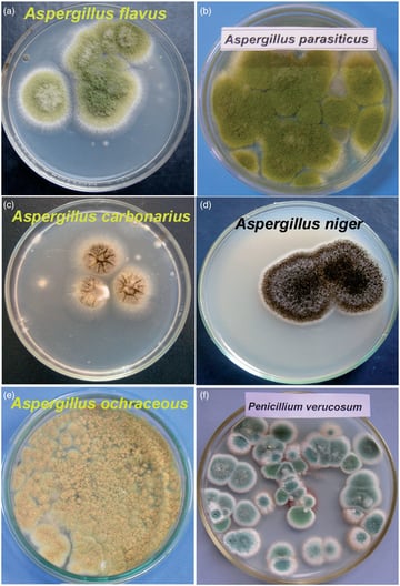 Czapek Dox Agar: Composition, Principle, and Colony Characteristics of Aspergillus and Penicillium