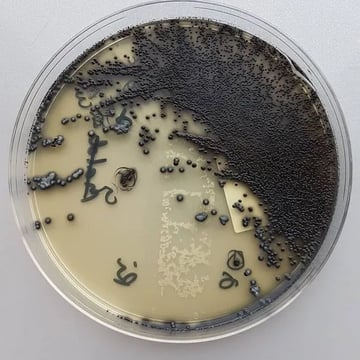 Tinsdale Agar: Composition, Preparation, Uses, and Colony Characteristics