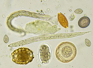 Laboratory Diagnosis of Intestinal Parasitic Infections: Methods, Specimen Handling, and When to Use Each Test