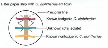 Elek Test (Elek's Gel Precipitation Test): Principle, Procedure, and Results