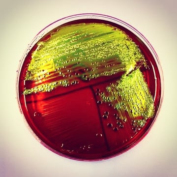 Diarrheagenic E. coli: ETEC, EPEC, EIEC, EHEC, and EAEC Explained