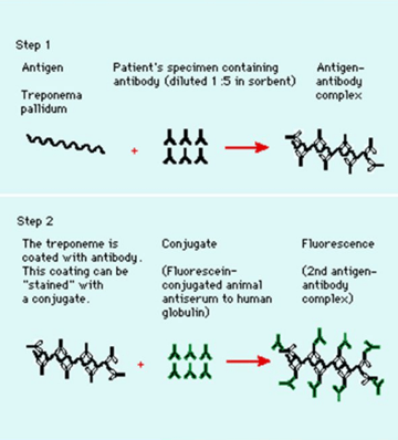 FTA-ABS Test: Interpretation, When It Confirms Syphilis, and FTA-ABS vs TPPA