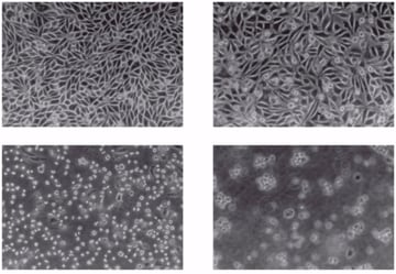 Cytopathic Effect (CPE) of Viruses: How Cell Damage Reveals the Culprit
