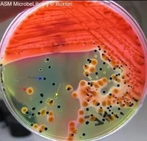 Hektoen Enteric (HE) Agar: Composition, Principle, Colony Characteristics, and Uses