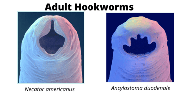 Hookworm (Ancylostoma duodenale and Necator americanus): Life Cycle, Pathogenesis, and Lab Diagnosis