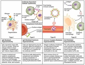 Hypersensitivity Reactions: The Four Types (Gell and Coombs Classification)