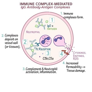 Type III Hypersensitivity: When Antibody and Antigen Clump in the Blood and Deposit Where They Should Not