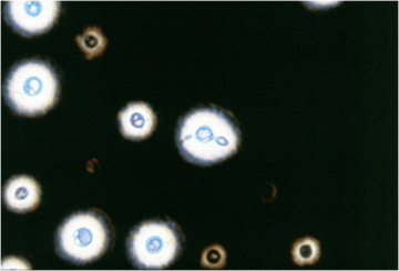 Laboratory diagnosis of Fungal Infections