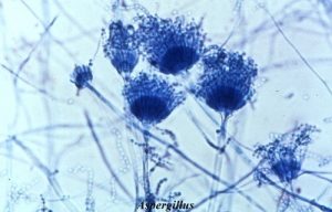 Lactophenol Cotton Blue (LPCB) Mount: Principle, Procedure, and Fungal Identification