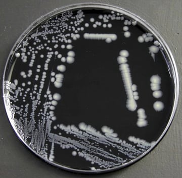 Buffered Charcoal Yeast Extract (BCYE) Agar: Composition, Principle, Uses, and Colony Characteristics