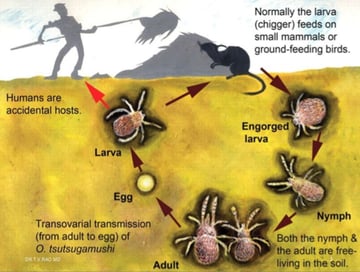 Scrub Typhus (Orientia tsutsugamushi): The Eschar, Diagnosis, and Treatment