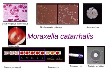 Moraxella catarrhalis: Identification, How to Tell It from Neisseria, and Disease