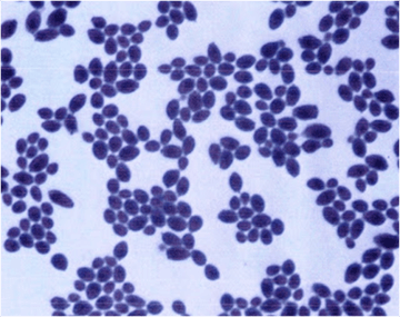 Candida albicans: Gram Stain, Morphology, Pathogenesis, and Lab Diagnosis