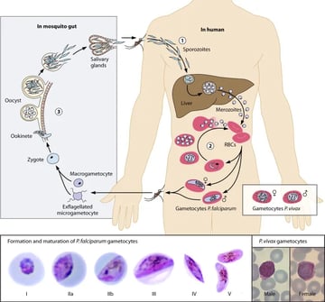 Plasmodium and Malaria: Life Cycle, Pathogenesis, and Laboratory Diagnosis