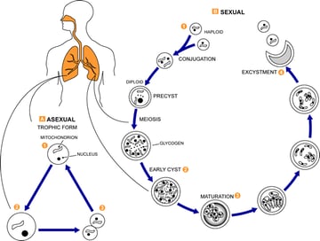 Pneumocystis jirovecii: Fungus or Protozoan, Pathogenesis, and Lab Diagnosis
