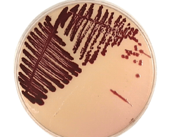 Serratia marcescens: The Red-Pigment Hospital Pathogen and How to Identify It