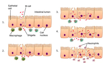Shigella: Identification, Pathogenesis, and Bacillary Dysentery