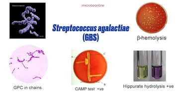 Streptococcus agalactiae (GBS): Properties, Pathogenesis, Lab Diagnosis