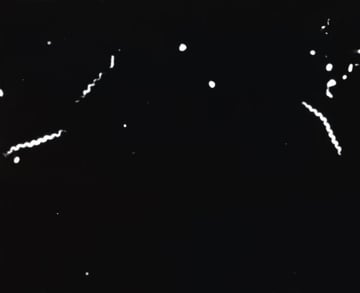 Demonstration of Treponema pallidum Using Dark-Field Microscopy