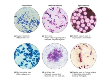 Staining Techniques in Microbiology: Which Stain for Which Specimen