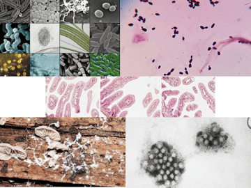 Microorganisms in Food: Types and Their Roles