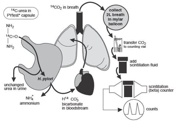 Urea Breath Test (UBT): Principle, Procedure, and Results