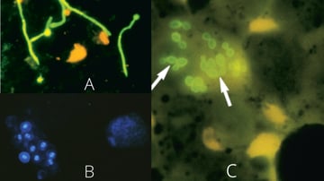  Calcofluor White Staining: Principle, Procedure, Results, and Clinical Applications