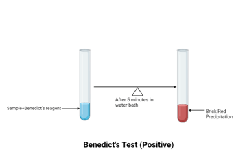 Benedict’s Test: Principle, Procedure, Uses, and Limitation