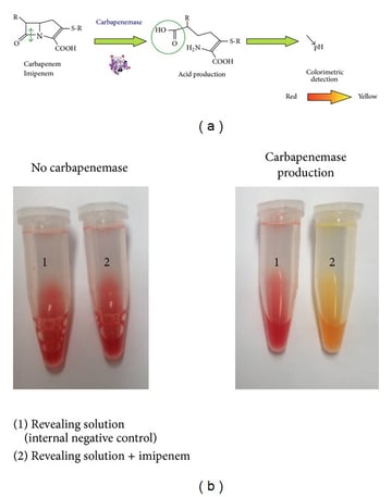 Carba NP Test (CNPt): Principle, Procedure, Results