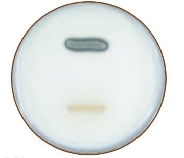 Casein Hydrolysis Test: Principle, Procedure, and Uses
