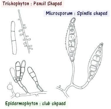 Dermatophytes: Tinea and Lab Diagnosis