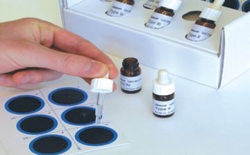 Heterophile Antigens: Definition, Examples, and Diagnostic Tests