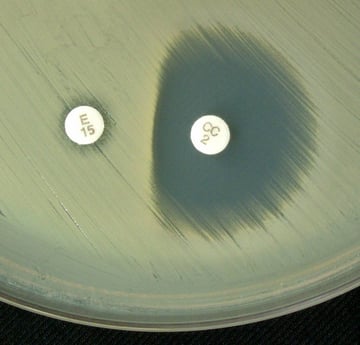 D-Test for Inducible Clindamycin Resistance: Why "Clindamycin-Susceptible" Isn't Always True