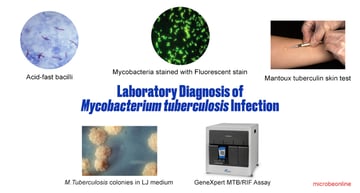Laboratory Diagnosis of Mycobacterium tuberculosis Infection