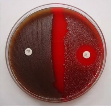Viridans Streptococci: Pathogenesis and Lab Diagnosis