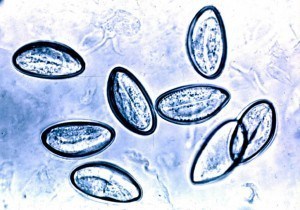 Cellophane Tape Test for Pinworm (Enterobius vermicularis): Principle, Procedure, and Results