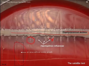Satellitism Test: How to Read It and Why Haemophilus Grows Only Near Staphylococcus