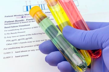 Antigen Detection Tests for Disease Diagnosis: Methods, Examples, and Clinical Uses