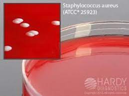 Columbia CNA Agar: Composition, Uses, and Colony Characteristics