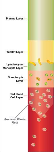 Quantitative Buffy Coat (QBC) Test: Principle, Procedure, Results, and Applications