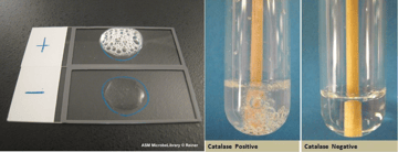 Catalase Test: The 3-Second Test That Separates Staph from Strep, and Five Ways It Lies