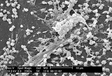 Staphylococcus epidermidis: Biofilm, Device Infections, and Lab Diagnosis