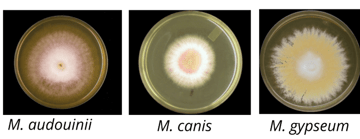 Microsporum: Species, Identification, and the Rice Grain Test