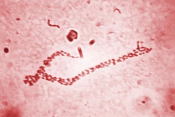 Haemophilus ducreyi: Chancroid, Soft vs Hard Chancre, and Lab Diagnosis