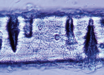 Hair Perforation Test: Principle, Procedure, and Interpretation