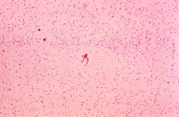 Flagella Staining: Principle, Ryu and Leifson Methods, Procedure, and Results