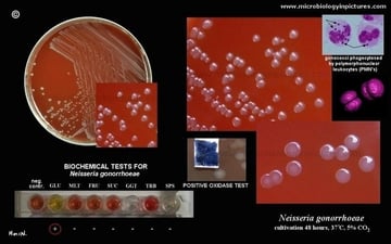Thayer-Martin Agar (Modified): Composition, Principle, Uses, and Colony Characteristics of Neisseria